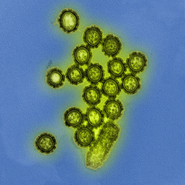 Particles of the H1N1 influenza virus. (Helmholtz Centre for Infection Research (HZI))