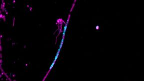 Fluoreszenzmikroskopische Aufnahme der RNA eines springenden Gens (türkis) innerhalb von Zellen von Methanothrix soehngenii (violett). Die RNA stammt von dem räuberischen Bakterium Candidatus Velamenicoccus archaeovorus und zeigt, das Introns zwischen verschiedenen Mikroorganismen in der Form von RNA übertragen werden können. (Bild:  Jens Harder / Max-Planck-Institut für Marine Mikrobiologie)