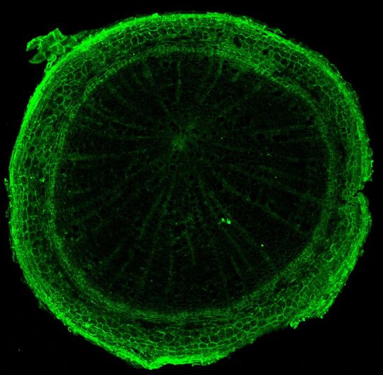 Unter dem Konfokalmikroskop werden in Hellgrün die fluoreszenzmarkierten Mikroplastikpartikel sichtbar, welche die Birke während der Wachstumsphase aufgenommen hat.(Bild:  Kat Austen)