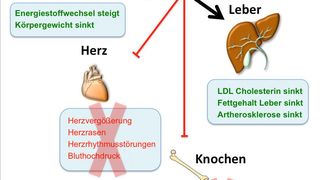 Glukagon/T3 verbessert Fettleber und Cholesterinspiegel ohne unerwünschte Effekte auf Herz und Knochen (Ausschnitt) (Grafik: Dr.Timo Müller; Quelle: HMGU)