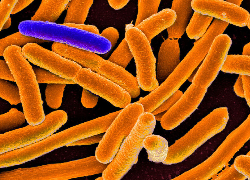 Manche Bakterien überdauern Antibiotikabehandlungen in einer Art Winterschlaf. (Beispielbild: Elektronenmikroskopieaufnahme von Escherichia coli; eingefärbt) (National Institute of Allergy and Infectious Diseases)