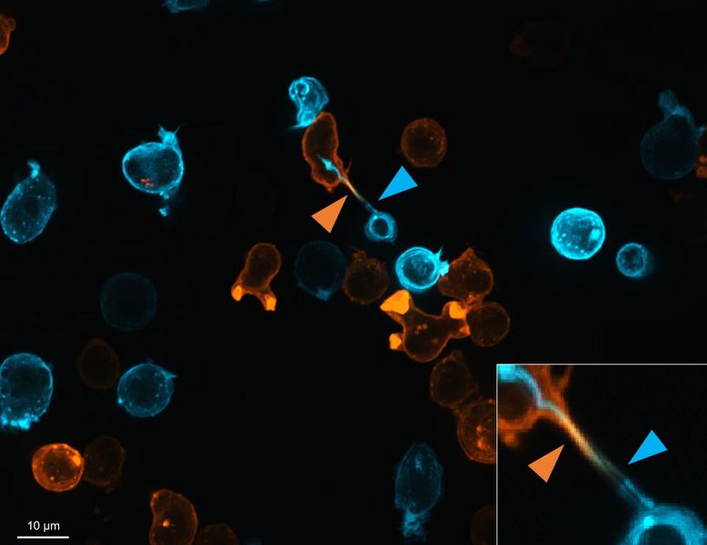 Amöben als Tunnelbaumeister   Wie kommunizieren Einzeller miteinander? Welche Kanäle nutzen sie, wenn Gefahr droht? Ein internationales Forschungsteam des Leibniz-HKI und des Exzellenzclusters „Balance of the Microverse“ der Universität Jena konnte nun erstmals einen besonderen „direkten Draht“ bei sozialen Amöben nachweisen: winzige Membrantunnel, die benachbarte Zellen miteinander verbinden. Diese „Nano-Pipelines“ dienen den Mikroben als Kommunikations- und Transportsystem für wichtige Zellbestandteile – ein potenzielles Erste-Hilfe-Netzwerk.  Auf der mikroskopischen Aufnahme sind die fadenförmigen Ausstülpungen zweier Amöbenzellen zu erkennen (blauer und orangefarbener Pfeil), die miteinander in Kontakt treten, bevor sie ein Tunnel-Nanoröhrchen bilden. Der Maßstabsbalken ist 10 µm lang.   Hier geht‘s zur Originalmeldung Wissenschaftsbild des Tages vom 15.10.2026  (Bild: Harikumar Suma | Leibniz-HKI)