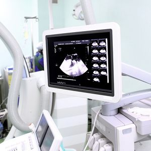 Moderne Medizingeräte sind komplex: Ihre Vermarktung an unterschiedliche Zielgruppen wie Ärzte oder Krankenhäuser ist es ebenfalls. Ein CRM-System erlaubt Herstellern, Kundenprozesse effizient zu gestalten.