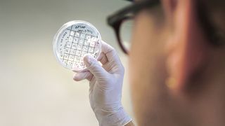 Auf der Suche nach dem optimalen Mikrobenstamm: Die Forschenden entwickeln im Projekt Carboncare Bakterien, die chemische Grundstoffe nachhaltig herstellen.
 (Bild: Charité/ Stefan Hristov)