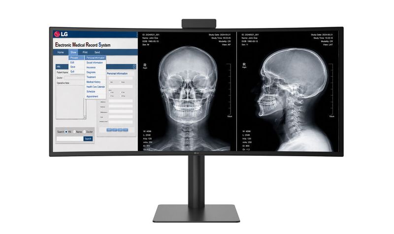 Der LG 40HT513D stellt mit seinem Black-IPS-Panel Bilder wie Röntgenaufnahmen mit hohem Kontrast dar. (Bild: LG Electronics)