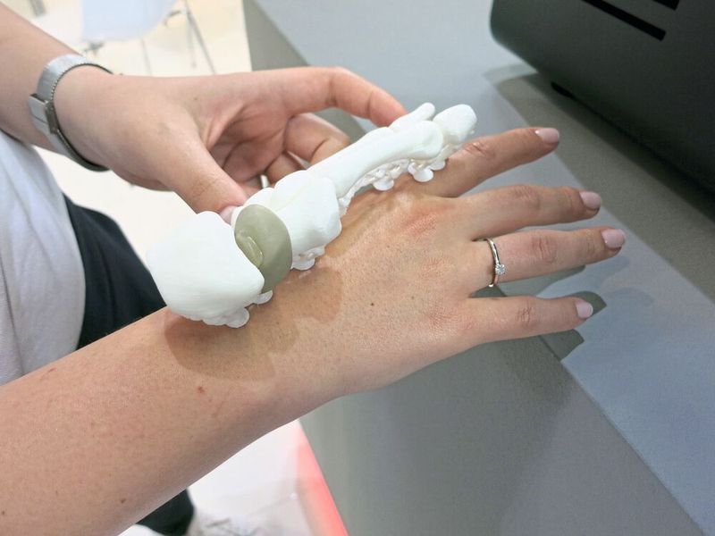 ... präsentiert das Handimplantat. (Bild: Schäfer / Devicemed)