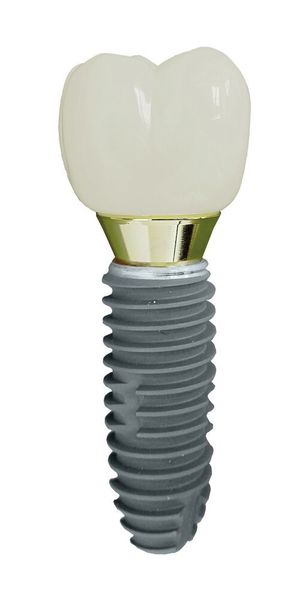 Typische Langdrehteile, links Knochenschrauben mit Schneckengewinde, rechts medizinische Implantate. (Utilis)