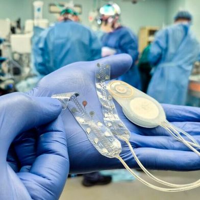 Das Brain-Computer-Interface (BCI) des Unternehmens CorTec aus Freiburg wurde zum zweiten Mal erfolgreich implantiert. (Bild: CorTec)