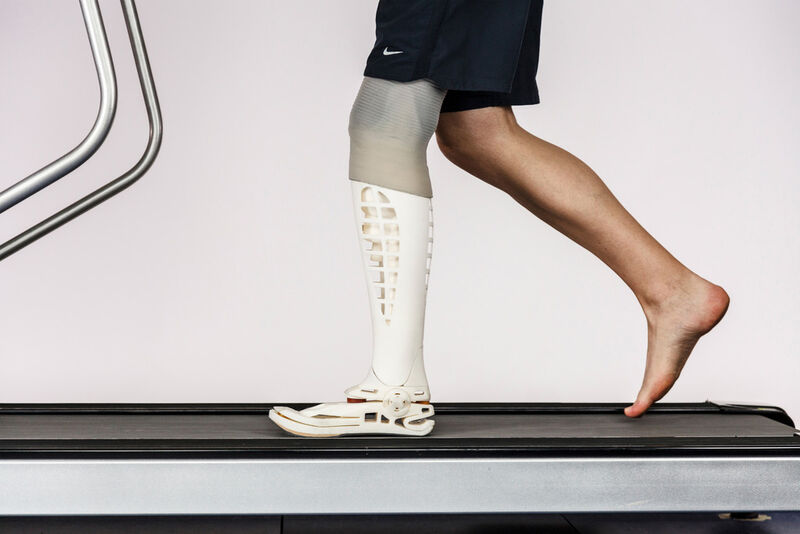 3D-gedruckte Beinprothesen erlauben eine bio-mechanische Formgebung. (Bild: Fraunhofer IPA)