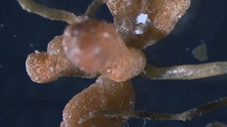 Knöllchenbakterien an Pflanzenwurzeln (Bild: Max-Planck-Institut für Biogeochemie)