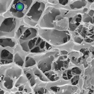 Abb. 2: Wie an den Gitterstäben eines Käfigs bleiben Nanopartikel an den steifen, dicken Gelstäben im Lungenschleim hängen.