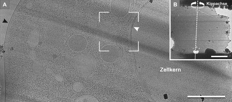 Abb.2: Kryo-Elektronenmikroskopische Aufnahme einer FIB-präparierten Zelle. A: Zu sehen ist der Zellkern (rechts) und die „Platzenge“ („molecular crowding“ – hohe Dichte der zellulären Bausteine) im Inneren der Zelle. Der Ausschnitt zeigt den Bereich aus Abbildung 3, aus dem ein Tomogramm erstellt wurde. Der weiße Pfeil markiert die Zellkernhülle, der schwarze Pfeil den Rand der Zelle (Maßstab 1 µm). B: Übersicht der Lamelle mit eingezeichneter Kippachse (Maßstab 2 µm). (Bild: Bäuerlein et. al.)