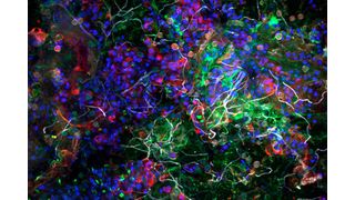 Aufnahme der Plastisphäre eines Partikels aus dem Pazifischen Ozean mittels eines konfokalen Laser-Scanning-Mikroskops. Das Bild zeigt die biologischen Bestandteile (angefärbt), die in unmittelbarer räumlicher Nähe koexistieren: Bakterien (grün), Algen (blau), extrazelluläre Zuckermatrix (rot), Pilzhyphen (weiß). (Bild:  Dr. Thomas Neu/UFZ)