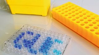 Die Nukleotidsequenz AUGUG in bakteriellen mRNAs kodiert für zwei überlappende Startcodons, die zu unterschiedlichen Proteinprodukten führen können. (Bild: MUI/Institut für Genomik und RNomik)