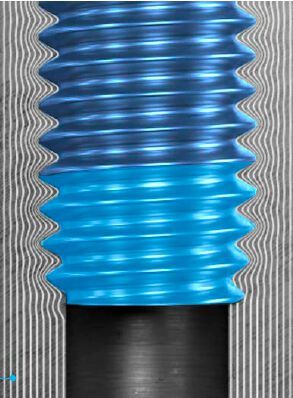 Die Furchzone ist mit einer Länge von 3 x p (p = Gewindesteigung) bauraum-optimiert. (Bild: Arnold Umformtechnik GmbH & Co. KG)