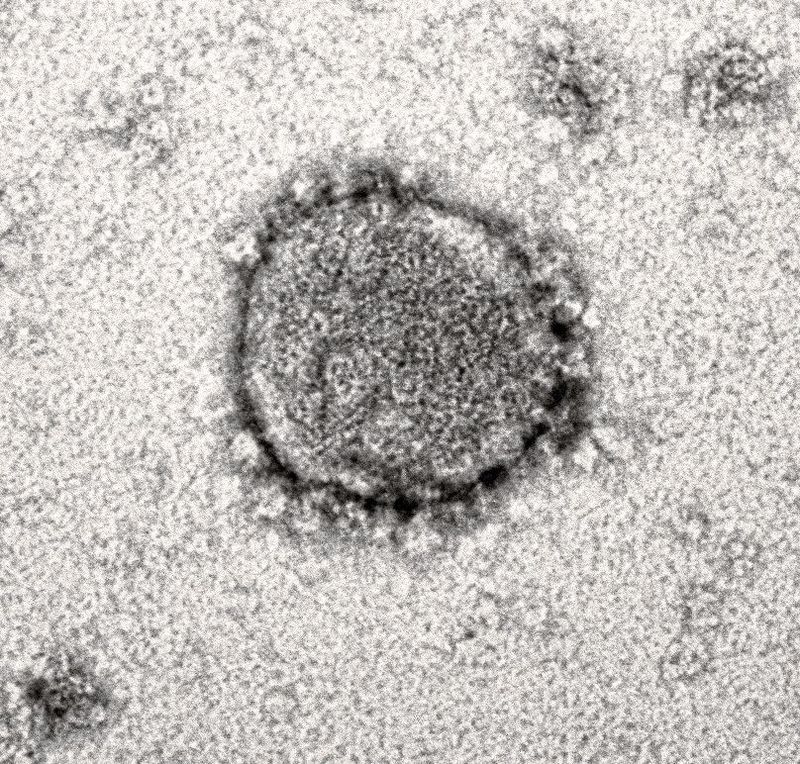Das neue Coronavirus steht im Zentrum zahlreicher Forschungsprojekte des Ulmer Instituts für Molekulare Virologie. Jetzt haben die Forschenden einen vielversprechenden zelleigenen und antiviralen Faktor charakterisiert