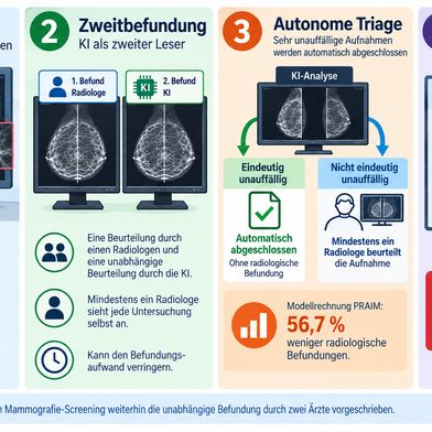 Drei Einsatzformen von KI im Mammografie-Screening und das Überwachungssystem, das im autonomen Betrieb bei Abweichungen auf radiologische Befundung zurückschaltet.  (Bild: KI-generierte / Redaktion Devicemed)