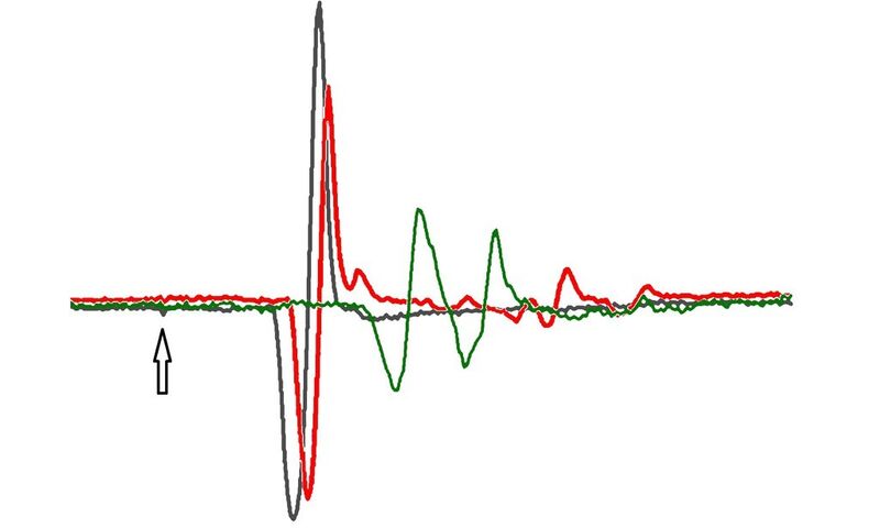 Die Kurven zeigen die zeitliche Reaktion von Nervenfasern, die so genannte Potenzialmessung, nach einer Stimulation (Pfeil). Die Reaktionszeit variiert zwischen einer normalen (grau), einer verzögerten (rot) und einer abgeschwächten Erregungsleitung (grün). (Bild: AG Saleh Ibrahim)