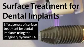 surface-treatment-for-dental-implants-xl (DataPhysics Instruments GmbH)