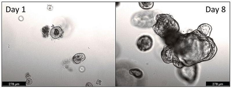 Humane Organoide gezüchtet aus Dünndarmgewebe (Zwölffingerdarm, Duodenum). Organoide bestehen aus Epithelzellen und können aus intestinalen Krypten, die aktive Stammzellen enthalten, kultiviert werden. Innerhalb von Tagen entwickeln sich Organoide aus kleinen, runden Strukturen zu größeren, komplexen Zellverbänden, die viele Aspekte der Darmphysiologie widerspiegeln. (Bild: TUM)