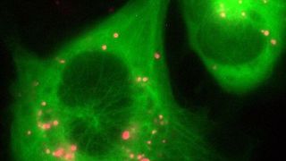 Die Aufnahme zeigt Zellen von Gefäßwänden (grün), die Nanopartikel (magneta) aufgenommen haben. (Bild: AG Kiemer/Saar-Uni)