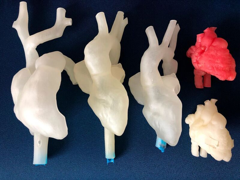 Die 3D-gedruckten Herzmodelle mit verschiedenen angeborenen Herzfehlern wurden auf Basis realer Herzdaten realisiert.  (LMU Klinikum/Carina Hopfner)