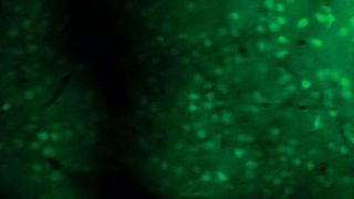 Hochauflösende Zwei-Photonen Mikroskopie-Aufnahmen, die über einen Ca-Indikator aktive Nervenzellen detektieren. ... (AUsschnitt) (Univ.-Prof. Dr. Susann Schweiger-Seemann, Universitätsmedizin Mainz)