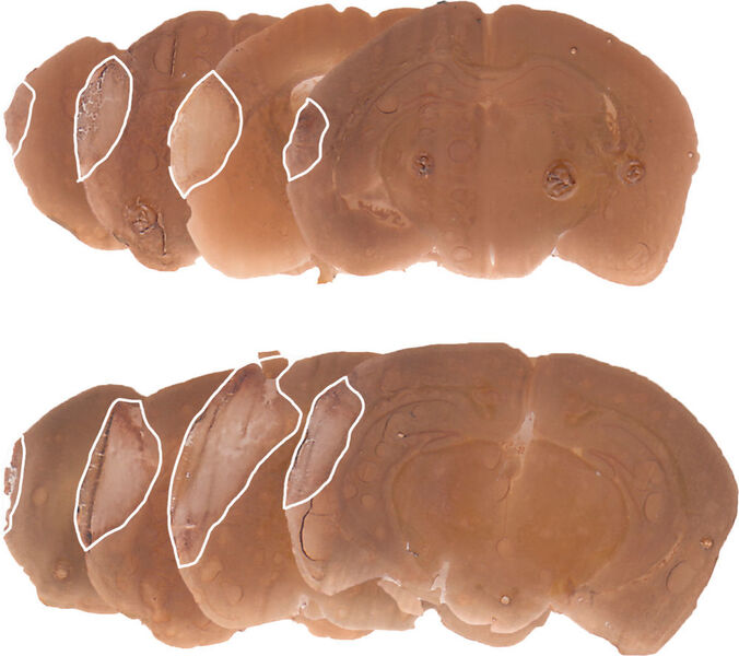 Gehirnschnitte von kontrollbehandelten (unten) und nasal Activin A-behandelten (oben) Mäusen nach einem Schlaganfall. Die weiße Linie markiert die Grenze zwischen den gesunden und geschädigten Gehirnregionen. (Dr. Bettina Buchthal)
