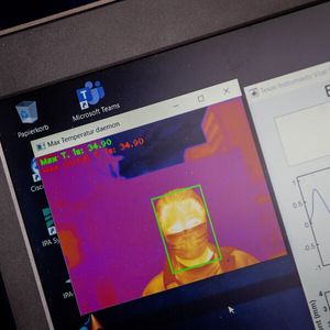 (Robert-Bosch-Krankenhaus/Christoph Schmidt)