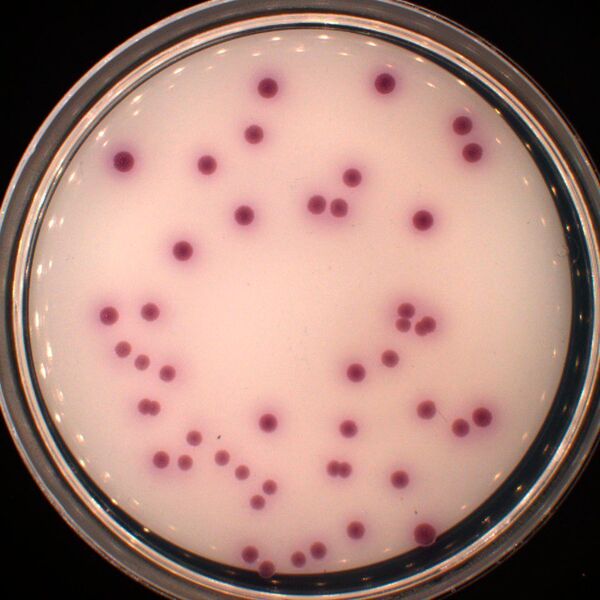 Verdünnungsreihen von Anreicherungskulturen auf selektivem Vibrio Chromagar. Die mauve-farbigen Kolonien sind ein Indikator für Vibrio parahaemolyticus, die aus einer Mikroplastipartikel-Probe aus der Nordsee stammen. (Alfred-Wegener-Institut / Antje Wichels)