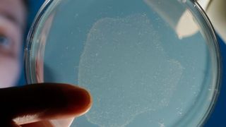 Mit dem bloßen Auge in der Petrischale kaum zu sehen, aber für die Forschung enorm wichtig: Der Fadenwurm Caenorhabditis elegans. (Jan-Peter Kasper/FSU)