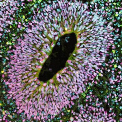 Ventrikel eines menschlichen Hirnorganoids (Bild: Indra Niehaus, Medizinische Hochschule Hannover)