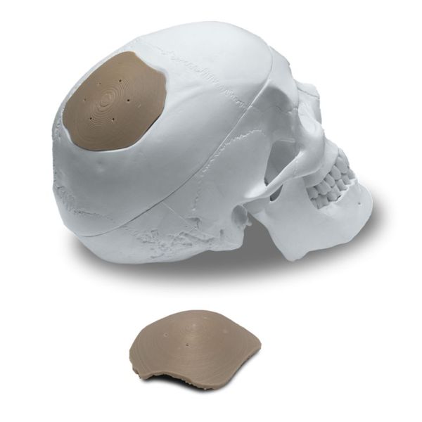 Beispiel für medizinischen 3D-Druck: eine Schädelplatte aus PEEK. (Kumovis)