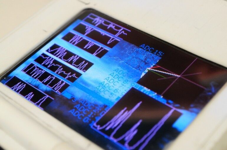 Die erfassten Messdaten stellt der Mark 2 auf einem OLED-Display dar (Bild: tricorderproject.org)