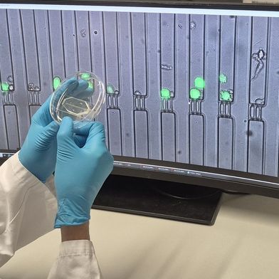 Abb. 1: Ein CellTrap-Chip vor dem Live-Mikroskopbild der Fallen. Jede Kammer enthält wenige Immun- und Krebszellen, deren Wechselwirkung über viele Stunden verfolgt wird. (Bild: TUM)