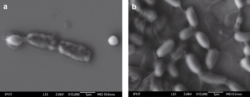 Abb. 2: Rasterelektronenmikroskopische Aufnahme von Bacillus thuringiensis in vegetativer Form (a) und als Endosporen (b). (Bild: Friedrich-Schiller-Universität Jena)