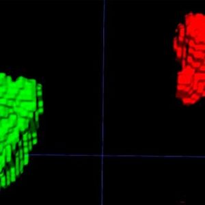 Left and right adrenal automated 3D segmentation in chest CT.(Source:  Elena Ghotbi, M.D., and RSNA)