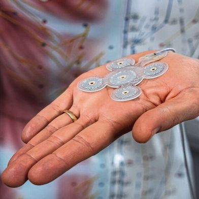 Edge-AI trifft Medizintechnik: Neurostimulation mit lokaler KI-VerarbeitungMit dem minimalinvasiven Gehirnstimulationssystem EASEE sind neue Therapien für medikamentenresistente Epilepsie mögilch. (Bild: Precisis)