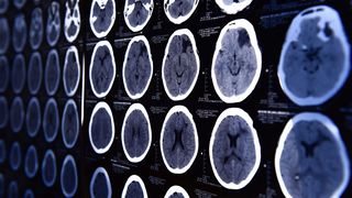 Bildgebende Verfahren wie die Computer-Tomographie (CT) erlauben tiefe Einblicke in den menschlichen Körper und sind mitunter für die Diagnostik unerlässlich. Nachteil sobald Röntgenstrahen ins Spiel kommen: Die Strahlenbelastung für den Körper der Patienten. (Symbolbild) (Bild: nimon_t - stock.adobe.com)