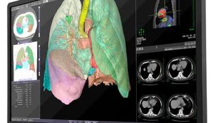 Der 8-Megapixel-Farbmonitor CL-R813 von JVC Kenwood (Bild: JVC Kenwood)