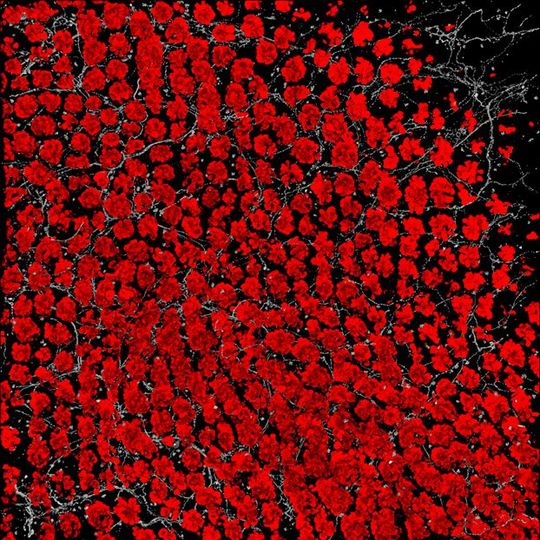 Harvard Medical School researchers have analyzed the molecular crosstalk between pain fibers in the gut and goblet cells that line the walls of the intestine. The work shows that chemical signals from pain neurons induce goblet cells to release protective mucus that coats the gut and shields it from damage. The findings show that intestinal pain is not a mere detection-and-signaling system, but plays a direct protective role in the gut. Harvard Medical School researchers have analyzed the molecular crosstalk between pain fibers in the gut and goblet cells that line the walls of the intestine. The work shows that chemical signals from pain neurons induce goblet cells to release protective mucus that coats the gut and shields it from damage. The findings show that intestinal pain is not a mere detection-and-signaling system, but plays a direct protective role in the gut.