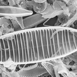 Kieselalgen im Rasterelektronenmikroskop(Bild:  AG Phykologie/ CCAC)