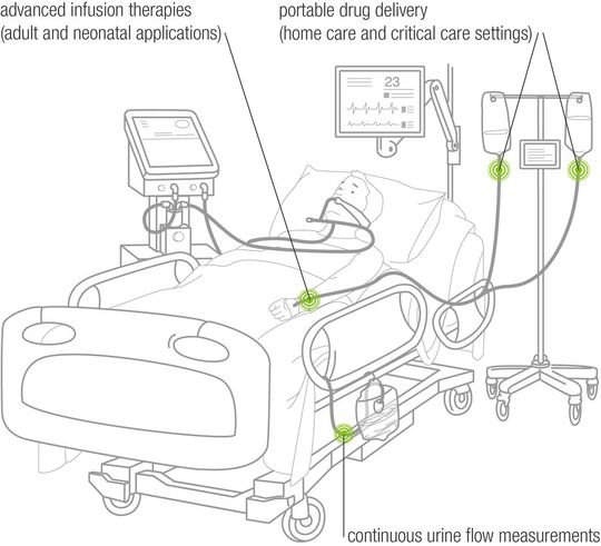 Mit einem Einweg-Durchflusssensor mit Durchflussraten von unter einem Milliliter in der Stunde sind für den Patienten lebensnotwendig. Mit einem Einweg-Durchflusssensor mit Durchflussraten von unter einem Milliliter in der Stunde sind für den Patienten lebensnotwendig.