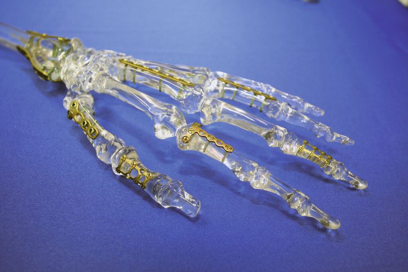 Medizintechnik in der Schweiz: orthopädische Implantate. (Bild: Anne Richter, SMM)