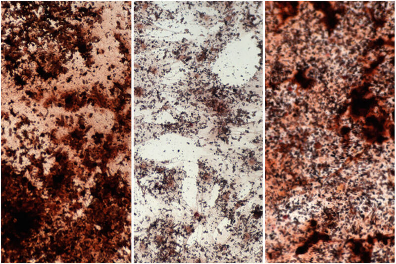 Angefärbtes Kalzium (dunkelbraun) in Stammzellen im Knochenmark: Junge Stammzellen (links) produzieren mehr Material für Knochen als alte Stammzellen (Mitte). Durch Zugabe von Natriumazetat lassen sie sich wieder verjüngen (rechts).