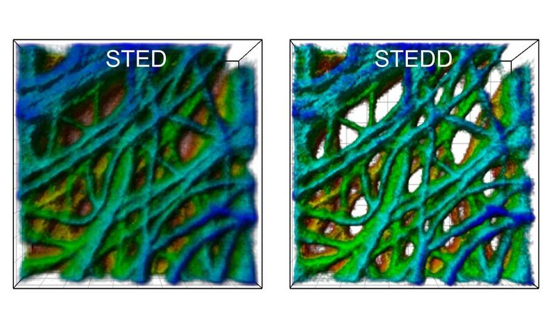 Eine Krebszelle unter dem Fluoreszenzmikroskop: Das STED-Bild (links) weist einen niedrig
aufgelösten Untergrund auf; beim STEDD-Bild (rechts) ist der Untergrund unterdrückt,
sodass die Strukturen besser zu erkennen sind. (APH/KIT)