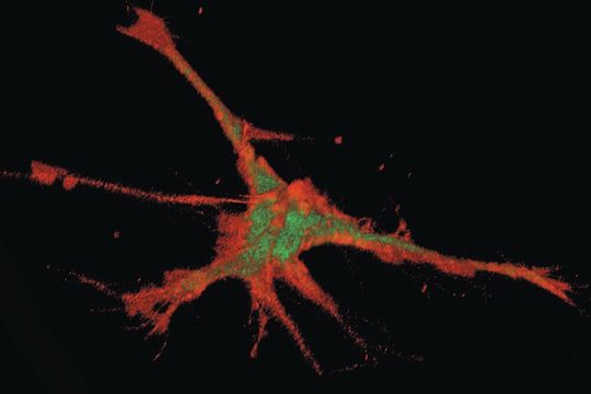 Magnetisch fanden die Nanopartikel ihren Weg in die Spitzen der Fortsätze von Nervenzellen. Magnetisch fanden die Nanopartikel ihren Weg in die Spitzen der Fortsätze von Nervenzellen.