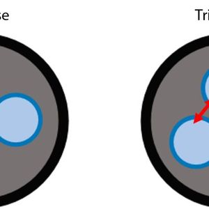 Schematische Darstellung des KI-basierten Abstandssensors mit zwei Objektiven (links) und des KI-basierten Abstandssensors mit drei Objektiven (rechts)(Bild:  Kyocera)