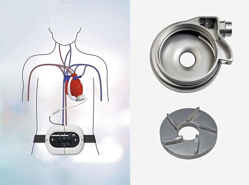 Die Firma Beutter unterstützt das von Rein VAD entwickelte vollimplantierbare Herzunterstützungssystem mit mechanischen Komponenten.