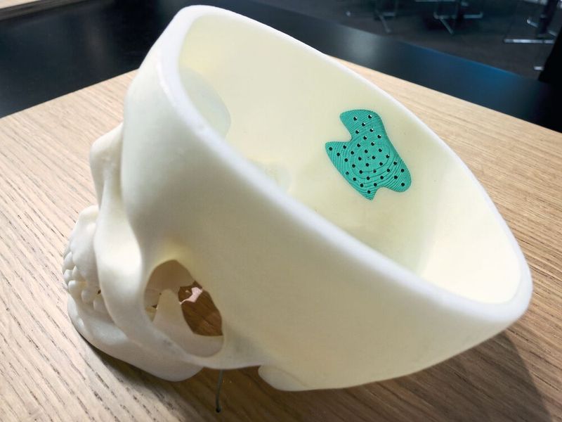 Mit medizinischen PLA-Kunststoffen (Polylactid) lassen sich auf dem Freeformer indidivuelle, das heißt patientenspezifische Schädelknochen fertigen. (Bild: Schäfer / Devicemed)